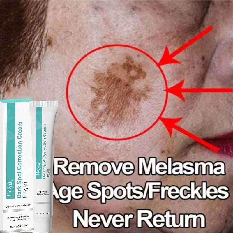 Luxury Skincare Brands - Krim Pemutih Penghilang Titik Kuat Mencerahkan