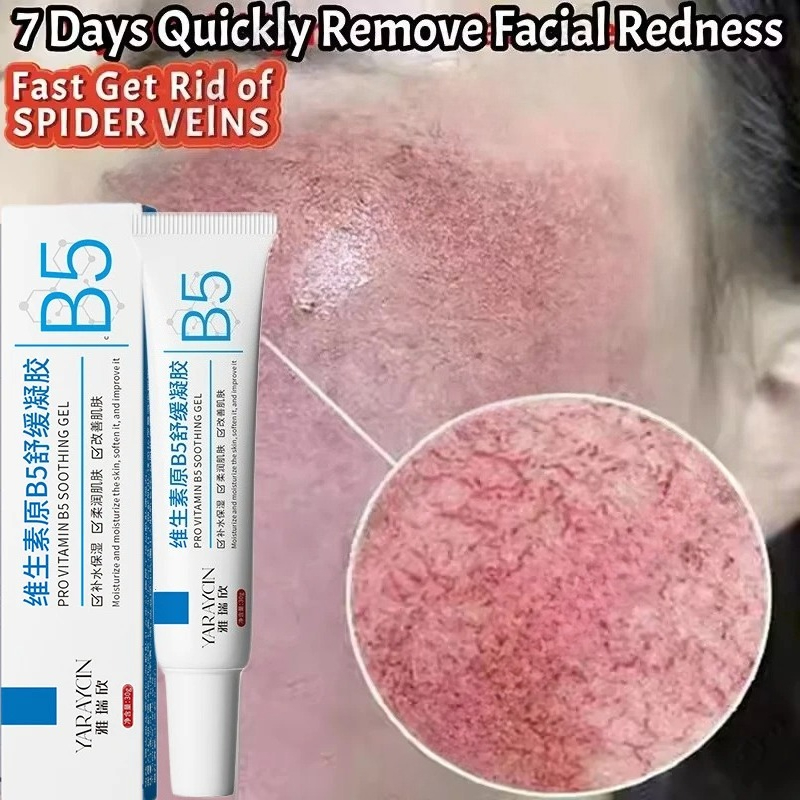 Luxury Skincare Brands - Krim Perbaikan Kemerahan Wajah Meningkatkan Kelembapan
