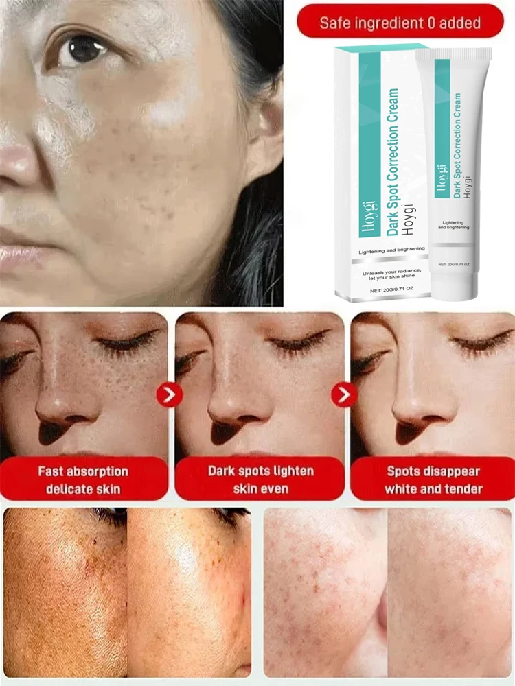 Krim Pemutih Penghilang Titik  - Luxury Skincare Brands ulasan dan harga