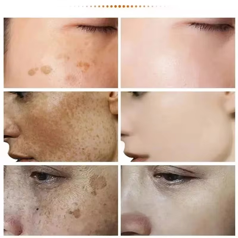 Krim Pemutih Penghilang Titik  - Luxury Skincare Brands ulasan dan harga