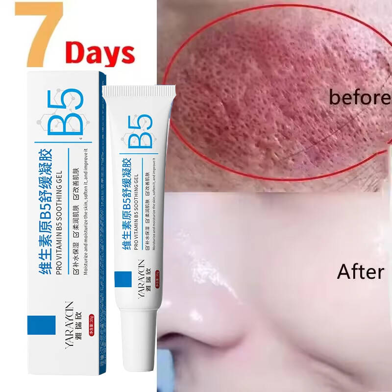 Krim Perbaikan Kemerahan Wajah - Luxury Skincare Brands ulasan dan harga