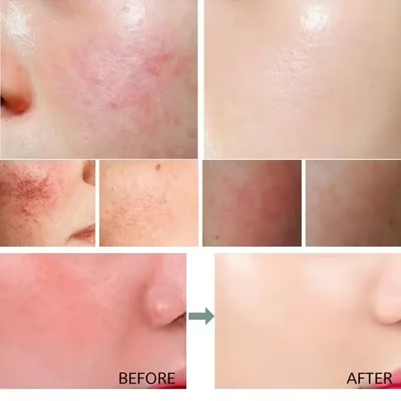 Krim Perbaikan Kemerahan Wajah - Luxury Skincare Brands ulasan dan harga