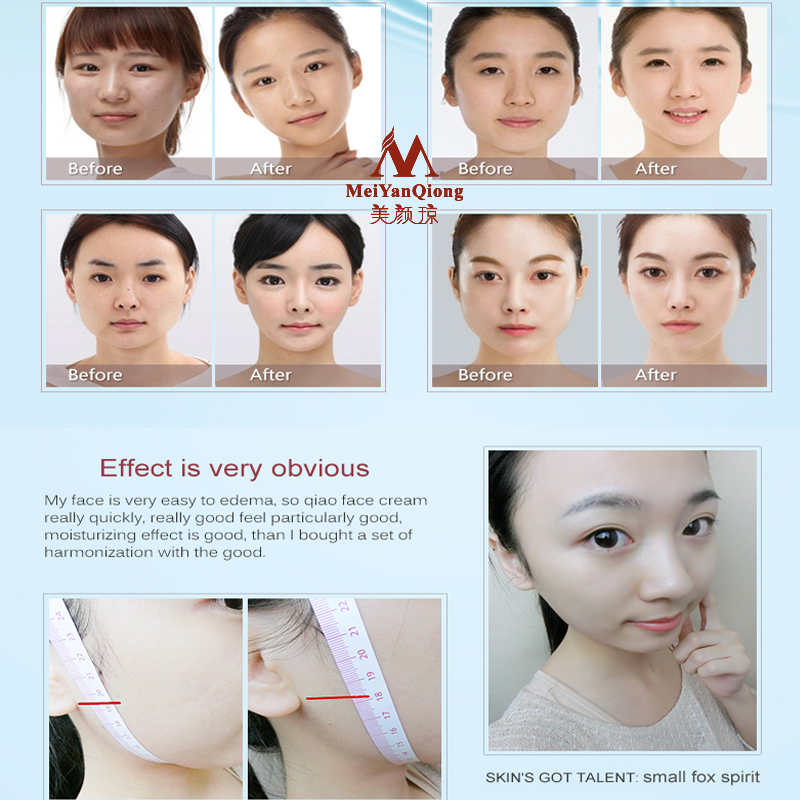 Wajah Lifting Shaping Perawata - Luxury Skincare China ulasan dan harga